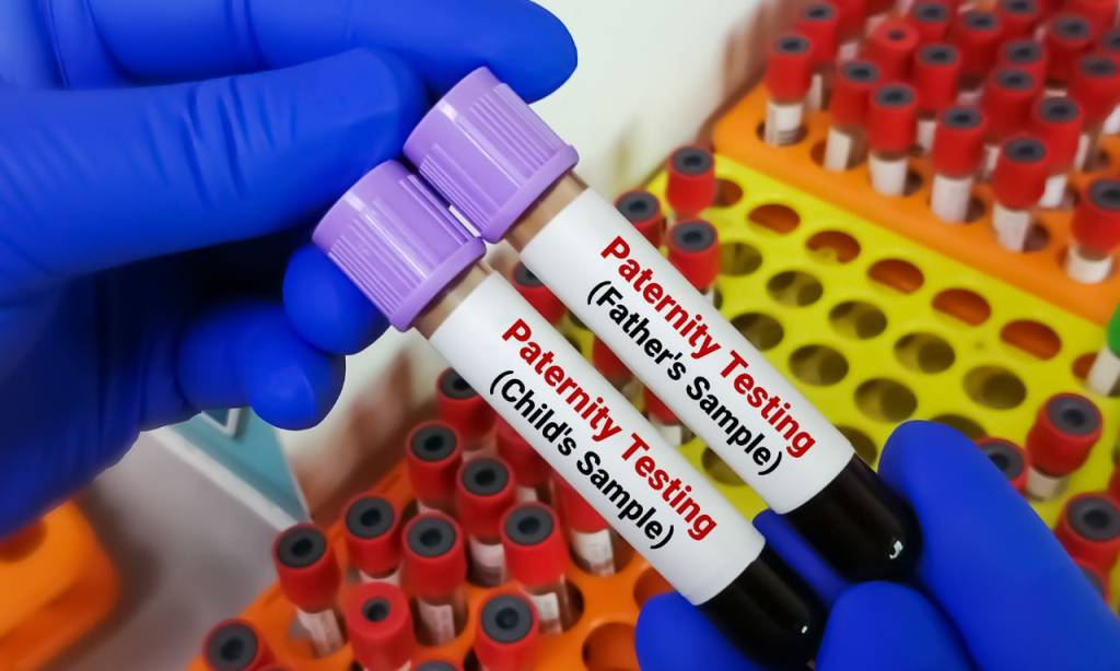 Recognition of Paternity Procedure, Defense, and Costs